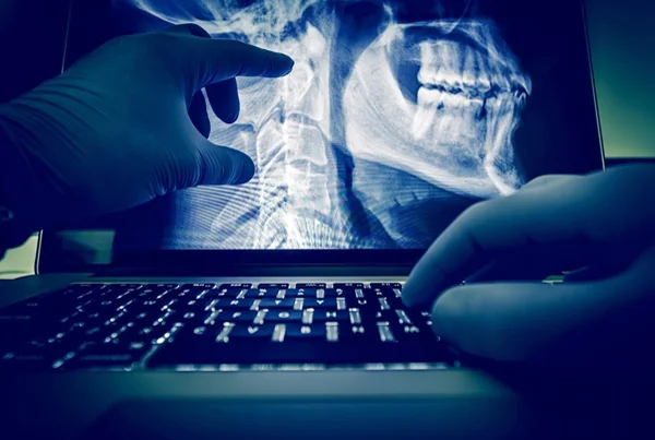 Digital X Ray