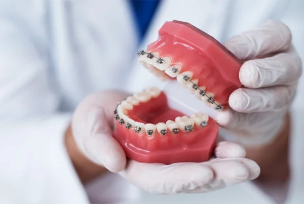Braces