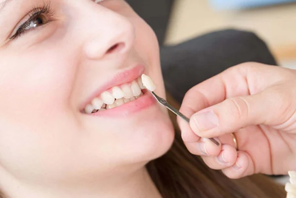 Teeth Whitening